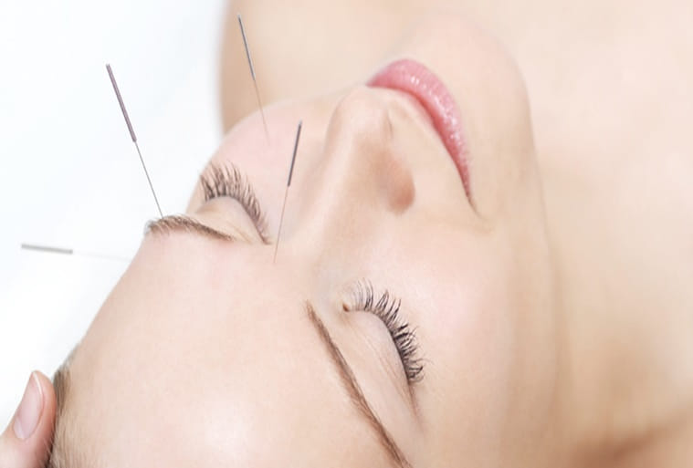 Acupunctură Cosmetică